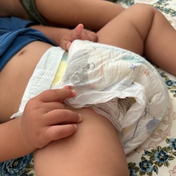 Prima Bebek Bezi Kalitesinde Düşüş Ve Lastik Sorunu
