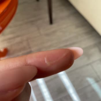 Sensodyne Ağızda Beyaz Salya