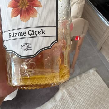 Anavarza Bal Şekerlenme Sorunu