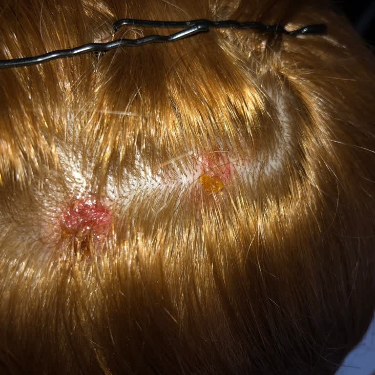 Palette Deluxe Saç Boyası İle Yaşadığım Ciddi Sorunlar