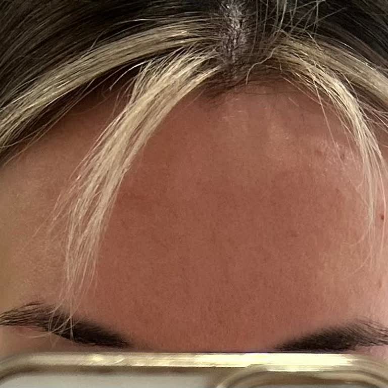 Volkan Kartal Kuaför Hayal Kırıklığı, Ombre Faciası