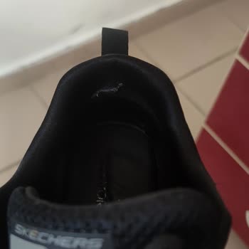 Skechers Bu Kadar Çabuk Açılma Yapması Normal Mi?