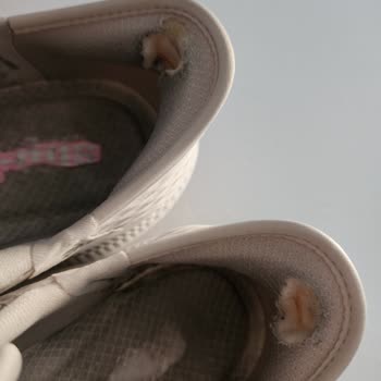 Skechers Spor Ayakkabı Mağduriyeti