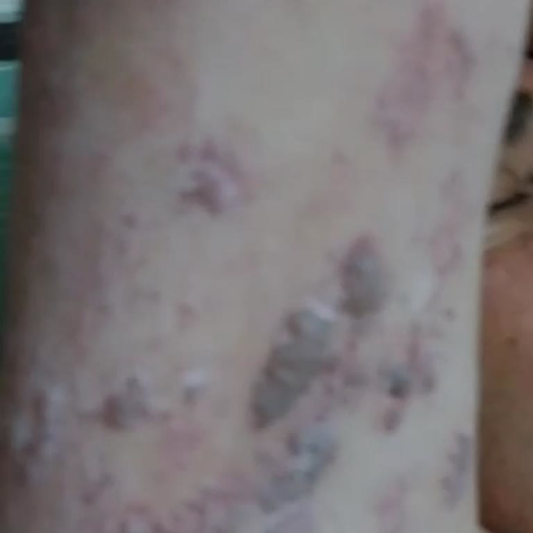 Silifke Devlet Hastanesi Hasta İhmali Silifke