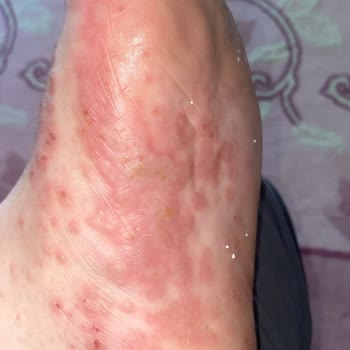 Abdi İbrahim Gold Away Kullandım Derim Kabar Kabar Oldu