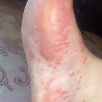 Abdi İbrahim Gold Away Kullandım Derim Kabar Kabar Oldu