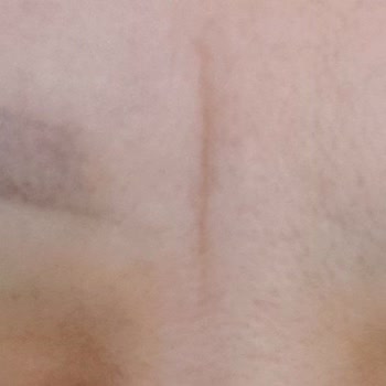 Serenat Pektaş Beauty Care Antalya'da Hayal Kırıklığı: Güzellik Merkezi Deneyimim!