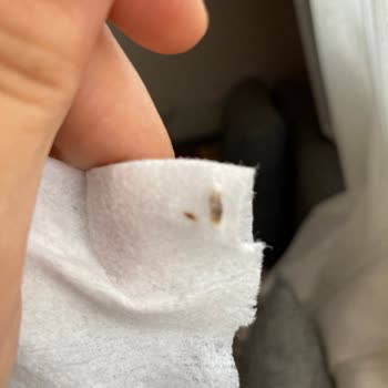 Uni Baby Yenidoğan Islak Mendil Cisim Çıktı.