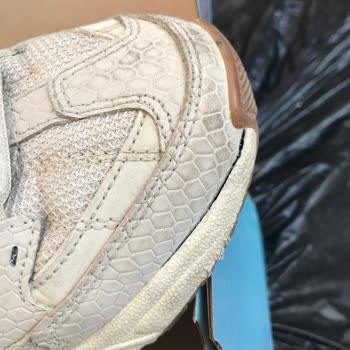 Skechers'ın Birkaç Ayda Patlayan Ayakkabısı!