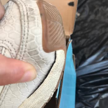 Skechers'ın Birkaç Ayda Patlayan Ayakkabısı!