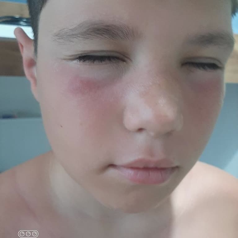 Sebamed Hayal Kırıklığı! Sebamed 50 Faktör Korumuyor