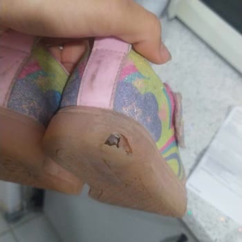 Skechers Markası Garanti Sözünde Durmuyor Kalitesiz Parçalanıyor