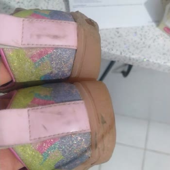 Skechers Markası Garanti Sözünde Durmuyor Kalitesiz Parçalanıyor