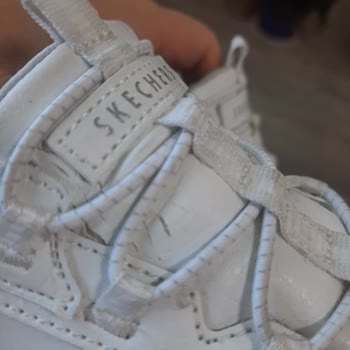 Derimod Ve Skechers Ayakkabıda Yaşanan Kalite Sorunu