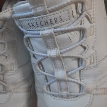 Derimod Ve Skechers Ayakkabıda Yaşanan Kalite Sorunu