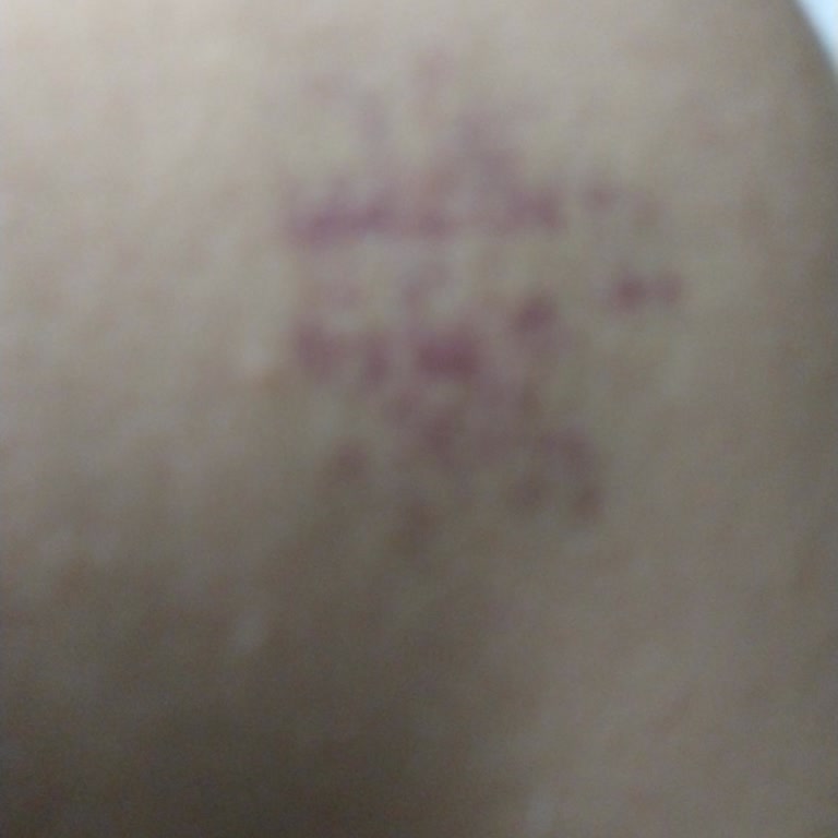 Sapanca Mavera Bungalow Mağduriyeti