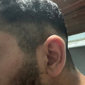 Tamev Philips Tıraş Makinesi Arızası