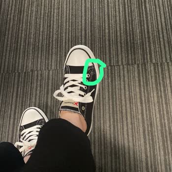 Polaris Ayakkabılar Ayağımı Yara Yaptı Ve Değişim Kabul Edilmedi