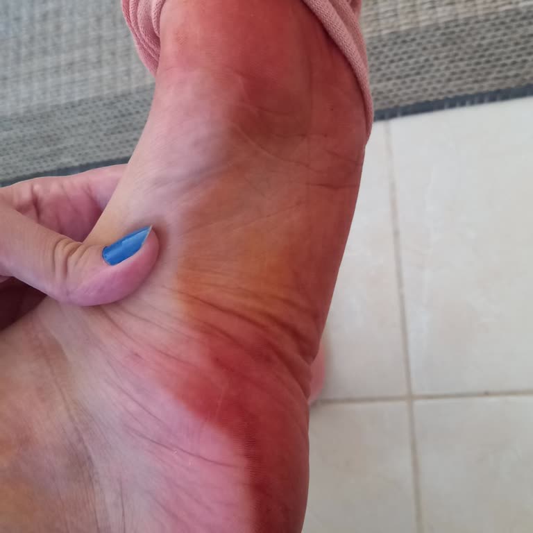 Polaris FLO'NUN Kalitesiz Terlikleri