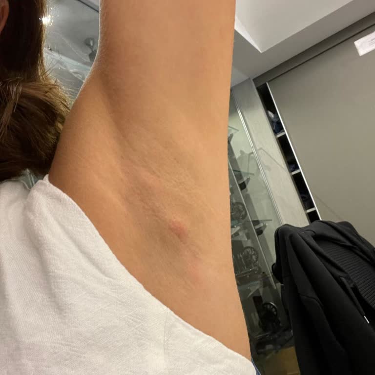 Rexona Clinical Protection Roll-on Koltuk Altı Bezesi