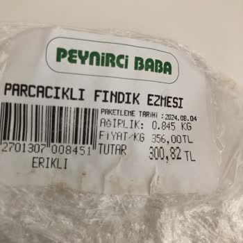 Peynirci Baba Fındık Kremasından Saç Çıktı