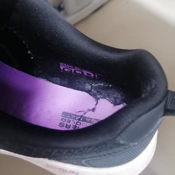 Skechers Ayakkabıda 1 Sene Dolmadan Deformasyon Oluştu!