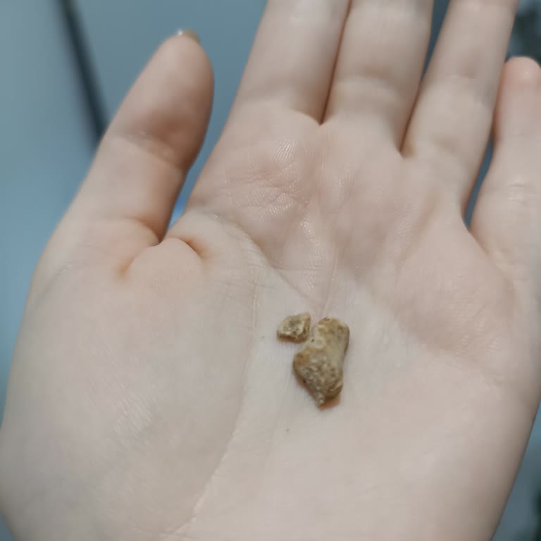 Şok Marketler Şok Marketten Aldığım Nohut Konservesinden Taş Çıktı