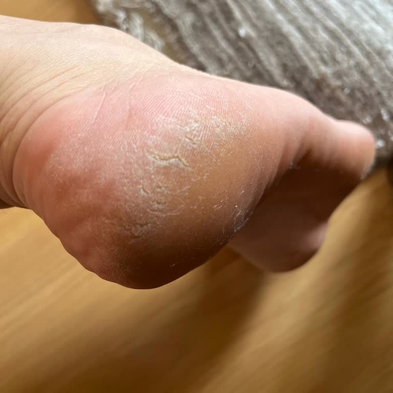 Bayraklı Tırnak Lounge Ayaklarımı Mahvetti