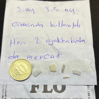 FLO Ayakkabı FLO, Lotto Marka Basketbol Ayakkabısı 3 Ayda Hüsran.