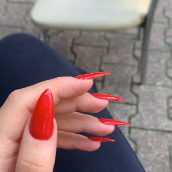 Hazal Akbay Beauty'de Protez Yaptırdım, Mağdur Oldum!