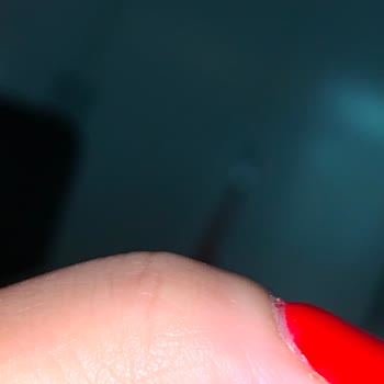 Hazal Akbay Beauty'de Protez Yaptırdım, Mağdur Oldum!