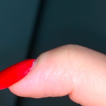 Hazal Akbay Beauty'de Protez Yaptırdım, Mağdur Oldum!