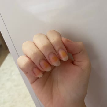 Flormar Oje Sarı Leke Bırakıyor