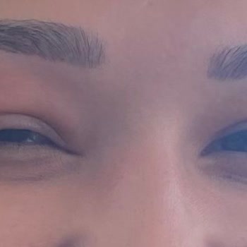 Infinity By Yelken Aquapark & Resorts İnfinity By Yelken Enfeksiyon