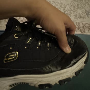 Amazon Skechers Ayakkabı Yırtılması Konusunda