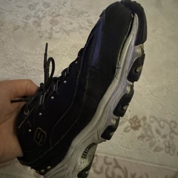 Amazon Skechers Ayakkabı Yırtılması Konusunda