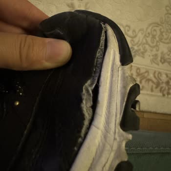 Amazon Skechers Ayakkabı Yırtılması Konusunda