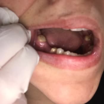 Alpi Diş Hastaneleri İstanbul Kaynarca Yaşanan Olumsuz Deneyim