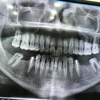 Alpi Diş Hastaneleri İstanbul Kaynarca Yaşanan Olumsuz Deneyim