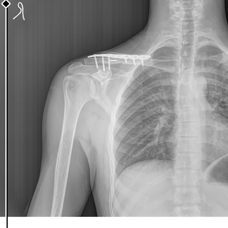 Quick Sigorta Kaza Tazminatı Ödemesi