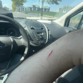 Turkcell Yanlış Tarife Ve Şiddet İçeren Kötü Müşteri Hizmeti Deneyimi