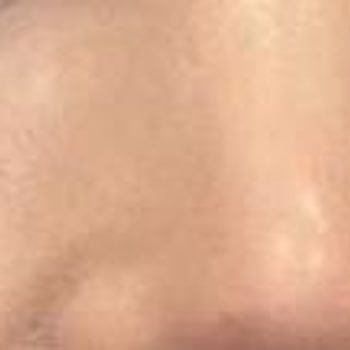 Uzm. Dr. Ekin Aykan Gözüm Şişti, Sorun Çözülmüyor