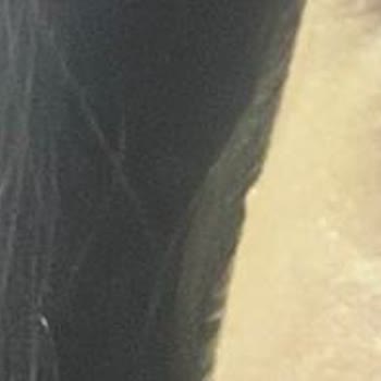 Uzm. Dr. Ekin Aykan Gözüm Şişti, Sorun Çözülmüyor