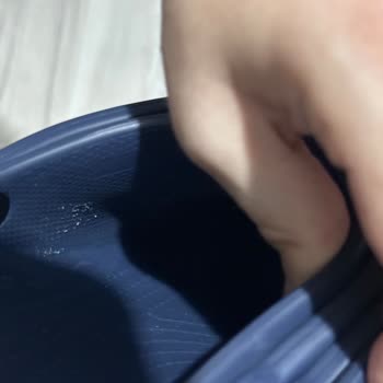 Trendyol Ayağımı Yara Yapan Terliği Geri Yollaması.