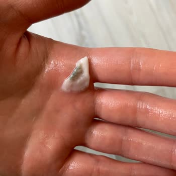 Nilky Son Kullanma Tarihi Geçmemiş Üründe Küf Şoku