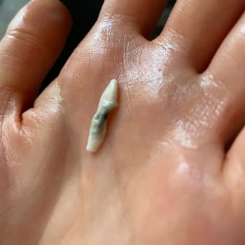 Nilky Son Kullanma Tarihi Geçmemiş Üründe Küf Şoku
