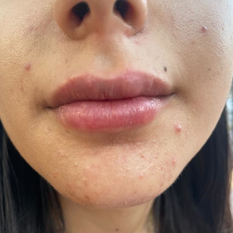 Fi Güzellik Merkezi'nde Yaşadığım Olumsuz Deneyim