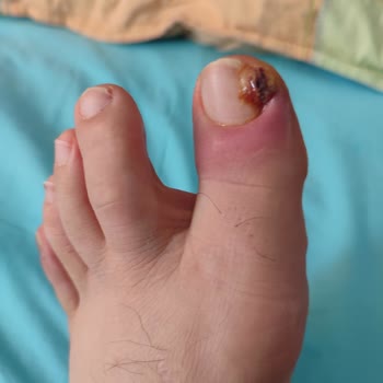 Derimod Size Hiç Yakışmadı. Yazıklar Olsun Hepinize