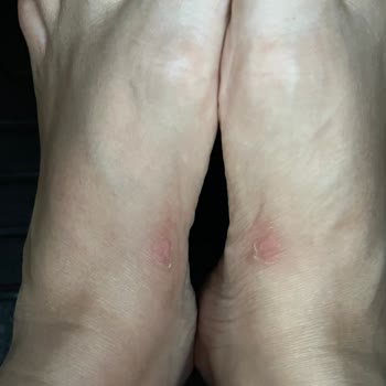 Greyder Terlikleri Ayak Sağlığımı Tehdit Ediyor!