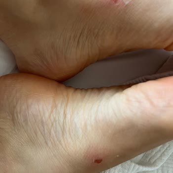 Greyder Terlikleri Ayak Sağlığımı Tehdit Ediyor!